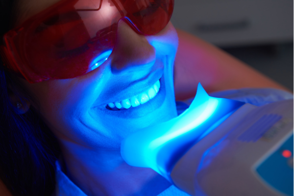 https://cayodental.lk/wp-content/uploads/2023/04/Teeth-Whitening.png